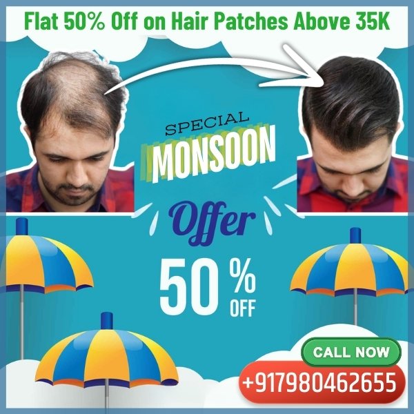 up to 50% off on all hair wigs and hair patches at non-surgical hair replacement center college street, kolkata this Monsoon Season. Best offer on hair wigs and hair patches in Kolkata.