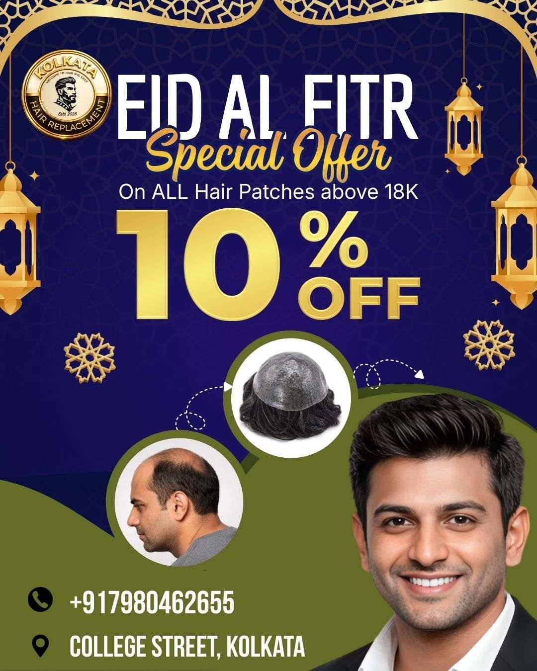 Eid special 10 percent discount on hair wig and hair patch in College Street Kolkata