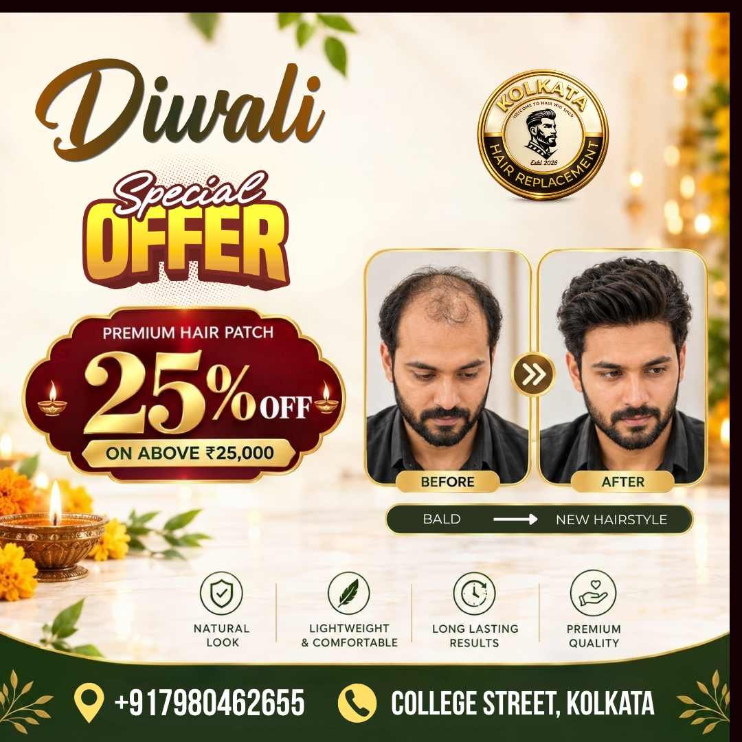 Diwali special Offer : 25% off on premium men's hair patches above ₹25,000 in Kolkata.